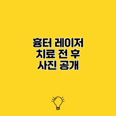 흉터 레이저 치료 전 후 사진 공개